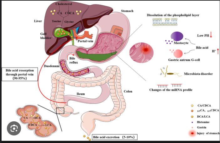 bile  reflux