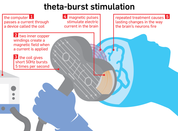 transcranial magnetic stimulation