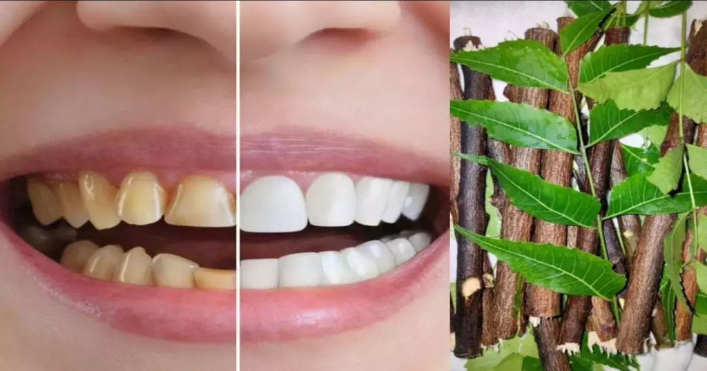 Herbs That Help In Teeth Whitening, Natural Way To A Brighter Smile, teeth Cleaning