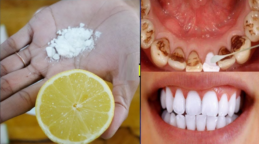 Herbs That Help In Teeth Whitening, Natural Way To A Brighter Smile, teeth Cleaning