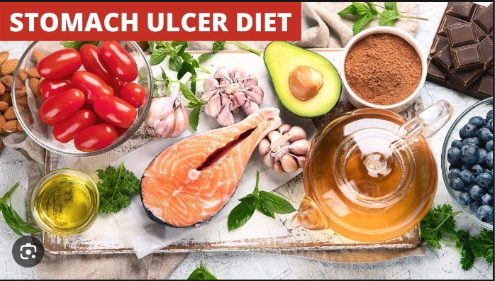 ulcer diet