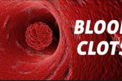 blood clot