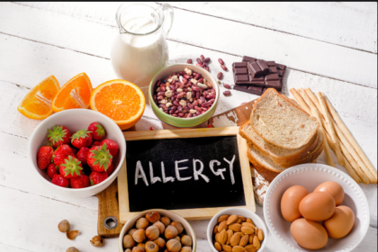 food allergies