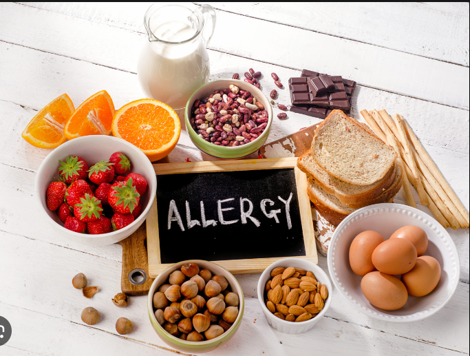 food allergies