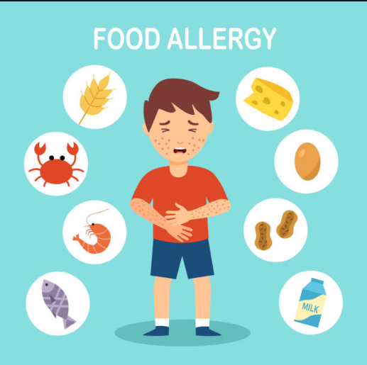 food allergies