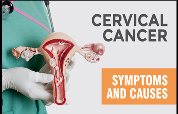 cervical cancer