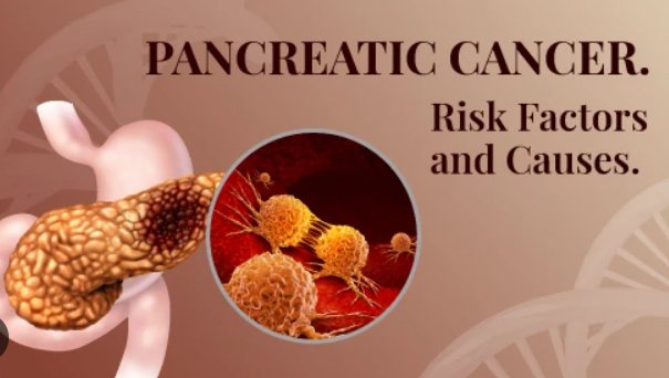 pancreatic cancer