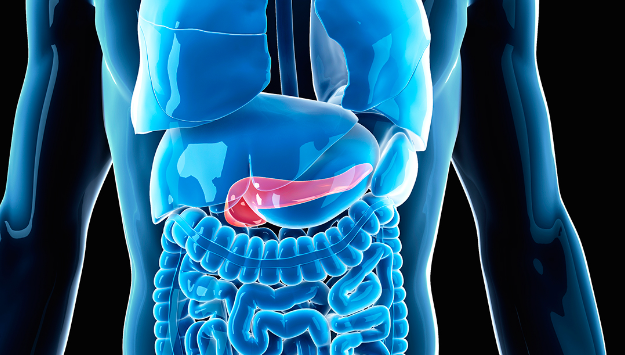 pancreatic cancer