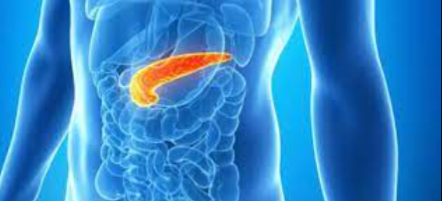 pancreatic cancer