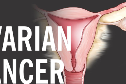 ovarian cancer