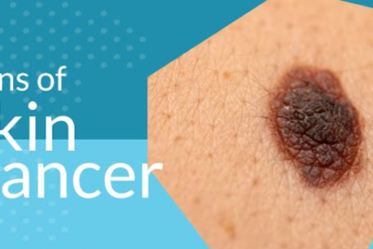 skin cancer