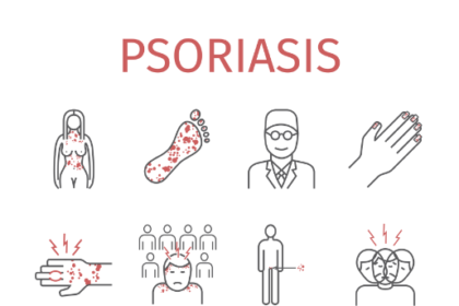 psoriasis