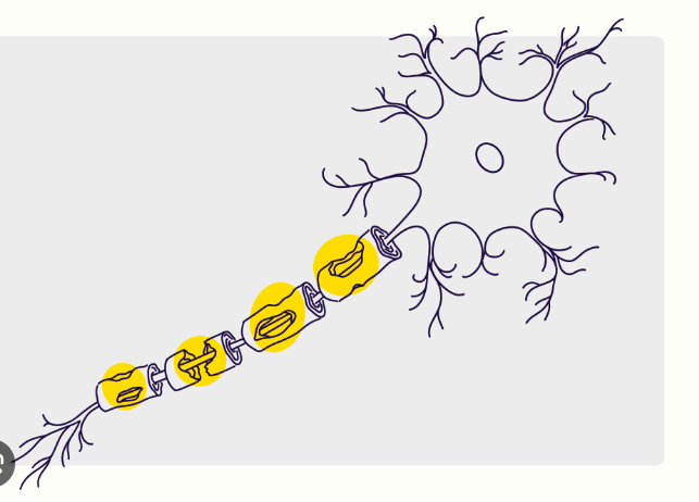 Multiple Sclerosis