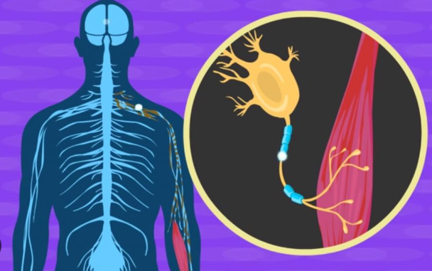 Amyotrophic Lateral Sclerosis