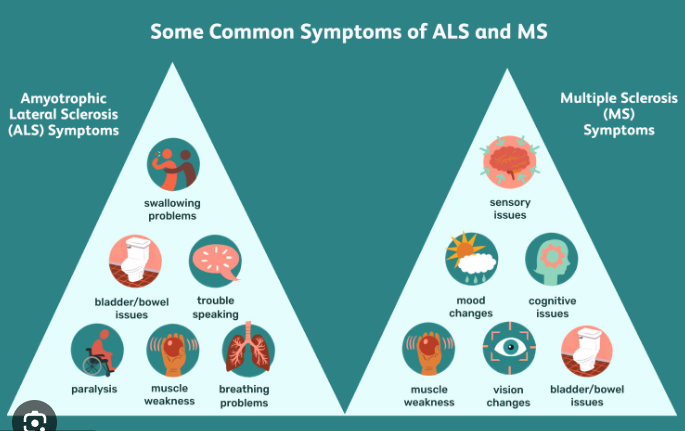 Amyotrophic Lateral Sclerosis