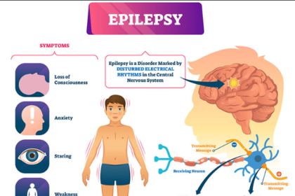 epilepsy