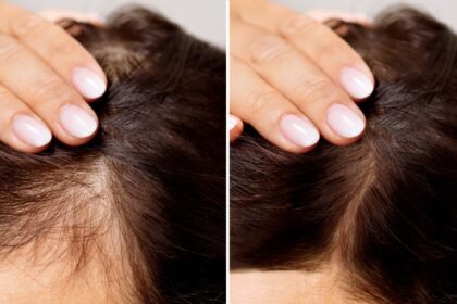 Habits Causing Hair Thinning, Hair damage, Hair, Healthy Hair, Shinning Hair, Strong Hair, Long Hair