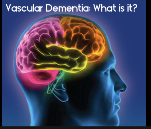 Vascular Dementia