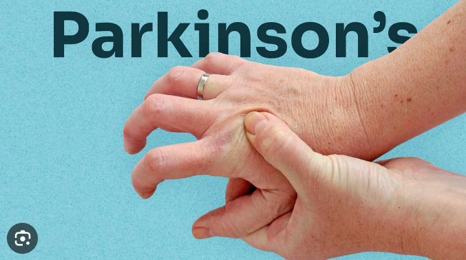 Parkinson’s disease