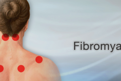 Fibromyalgia