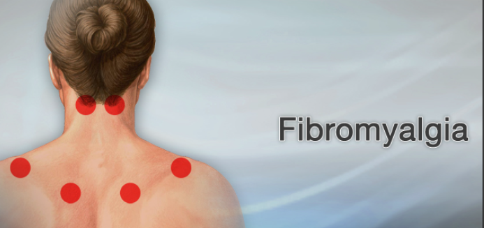 Fibromyalgia