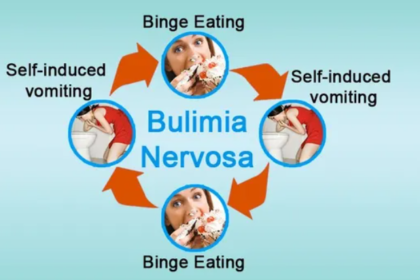 Bulimia Nervosa