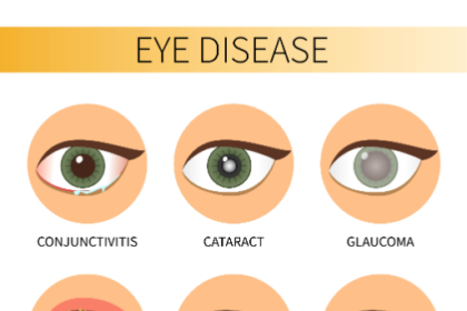 eye disease