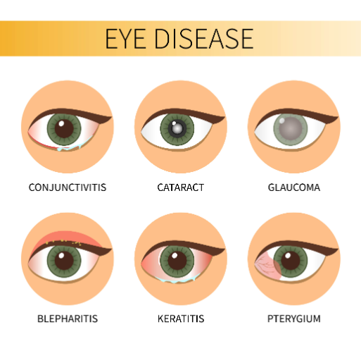 eye disease