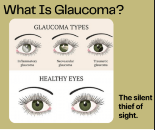 Glaucoma