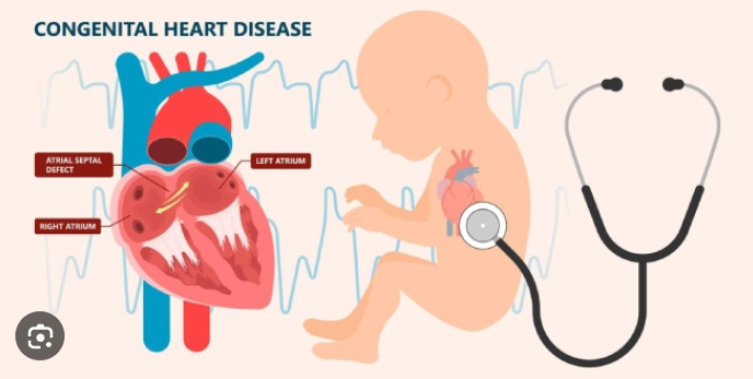 Congenital Heart Disease