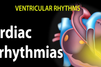 Heart Arrhythmias