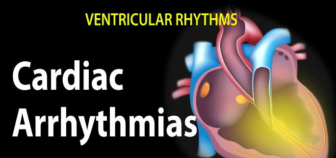 Heart Arrhythmias