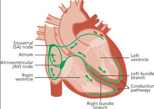 Heart Arrhythmias