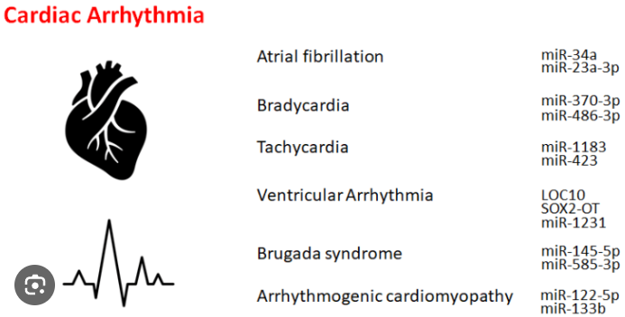 Heart Arrhythmias