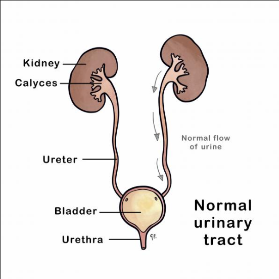 Kidney Reflux