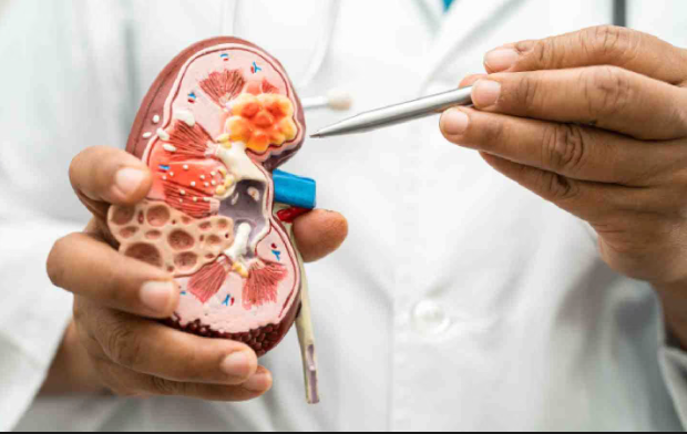 kidney disease