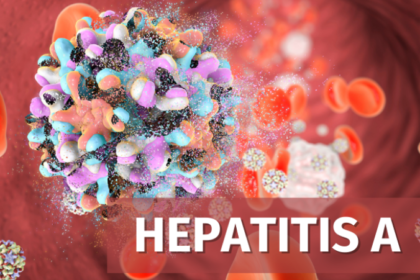 Hepatitis A