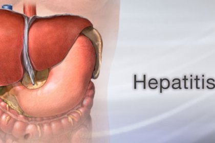 Hepatitis b