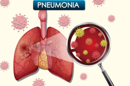 Pneumonia