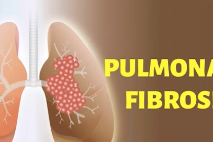 Pulmonary Fibrosis