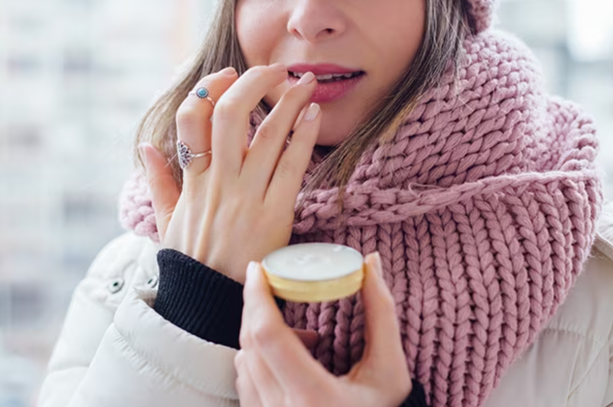 Common Winter Skin Problems