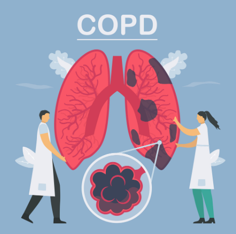 COPD