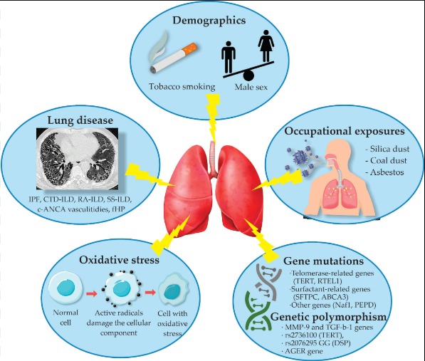 Pulmonary Fibrosis