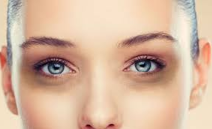 Dark Circles, Tips To Reduce Dark Circles