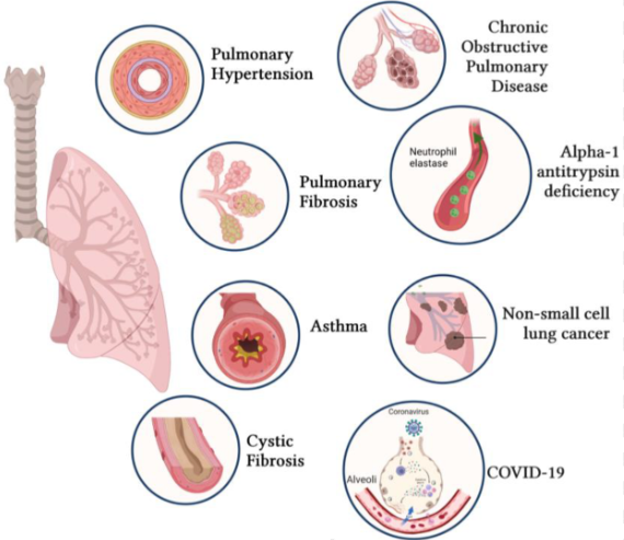 Respiratory Disease