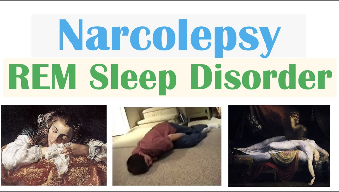 Narcolepsy