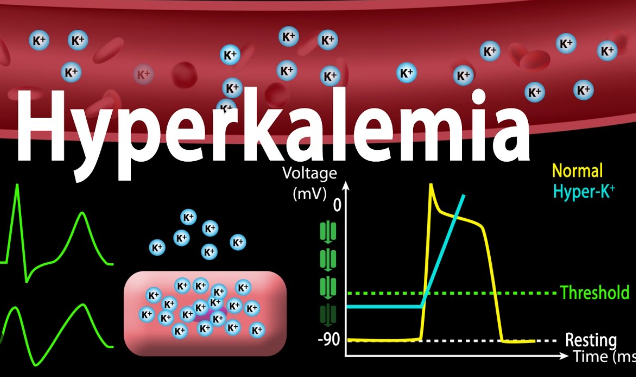 Hyperkalemia