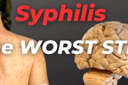 Syphilis