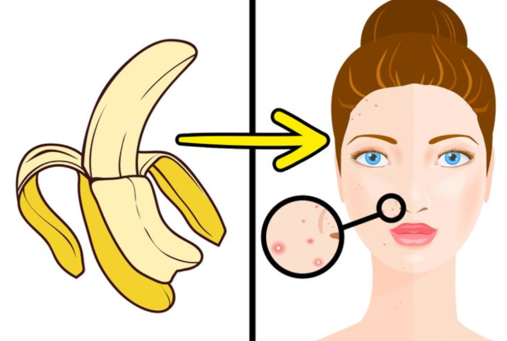 Banana Pills For Radiant Skin, Glowing skin, Beauty