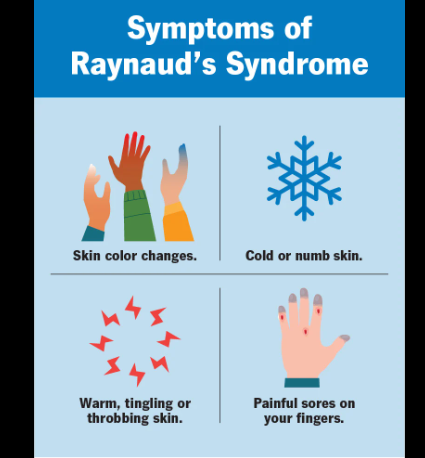 Raynaud's Syndrome